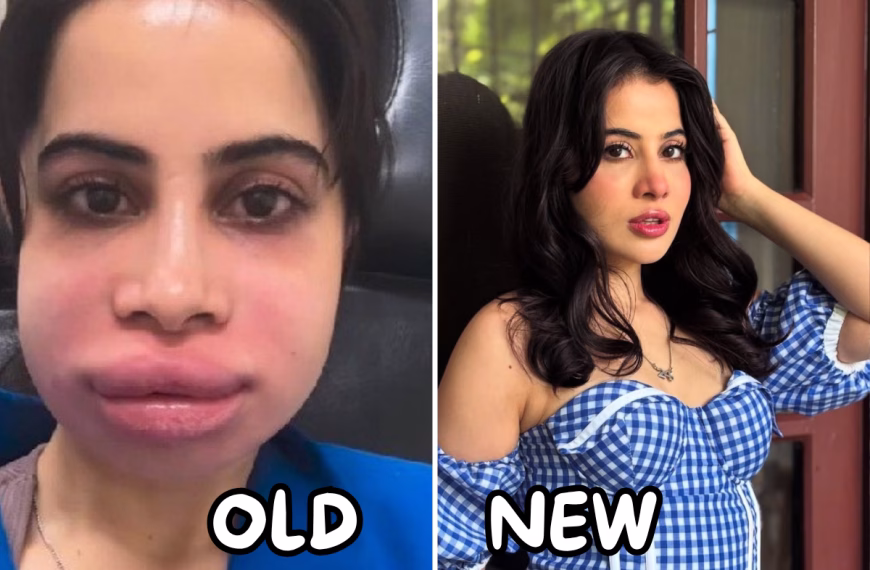 URFI javed new lips